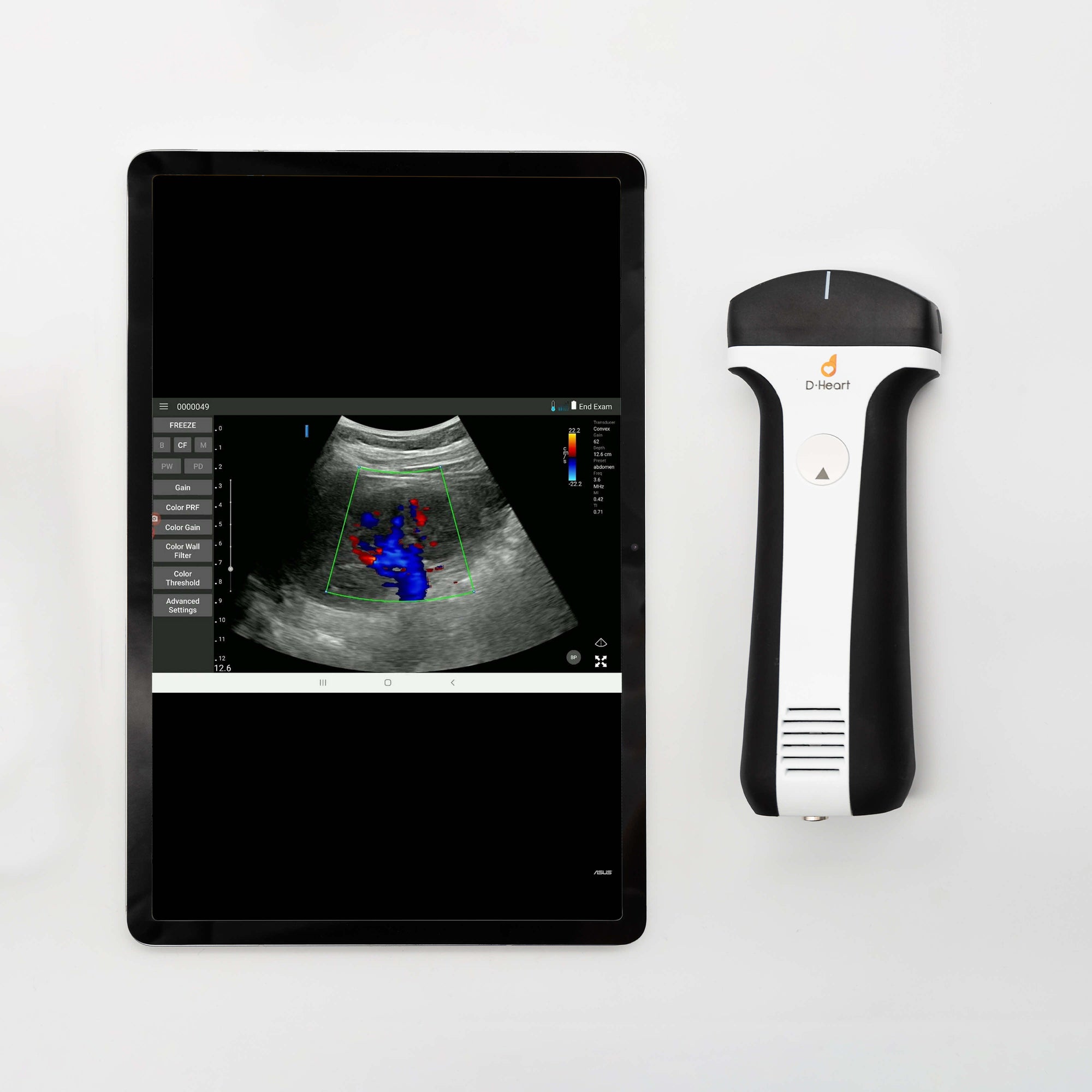 D-HEART SCANNER CONVEX