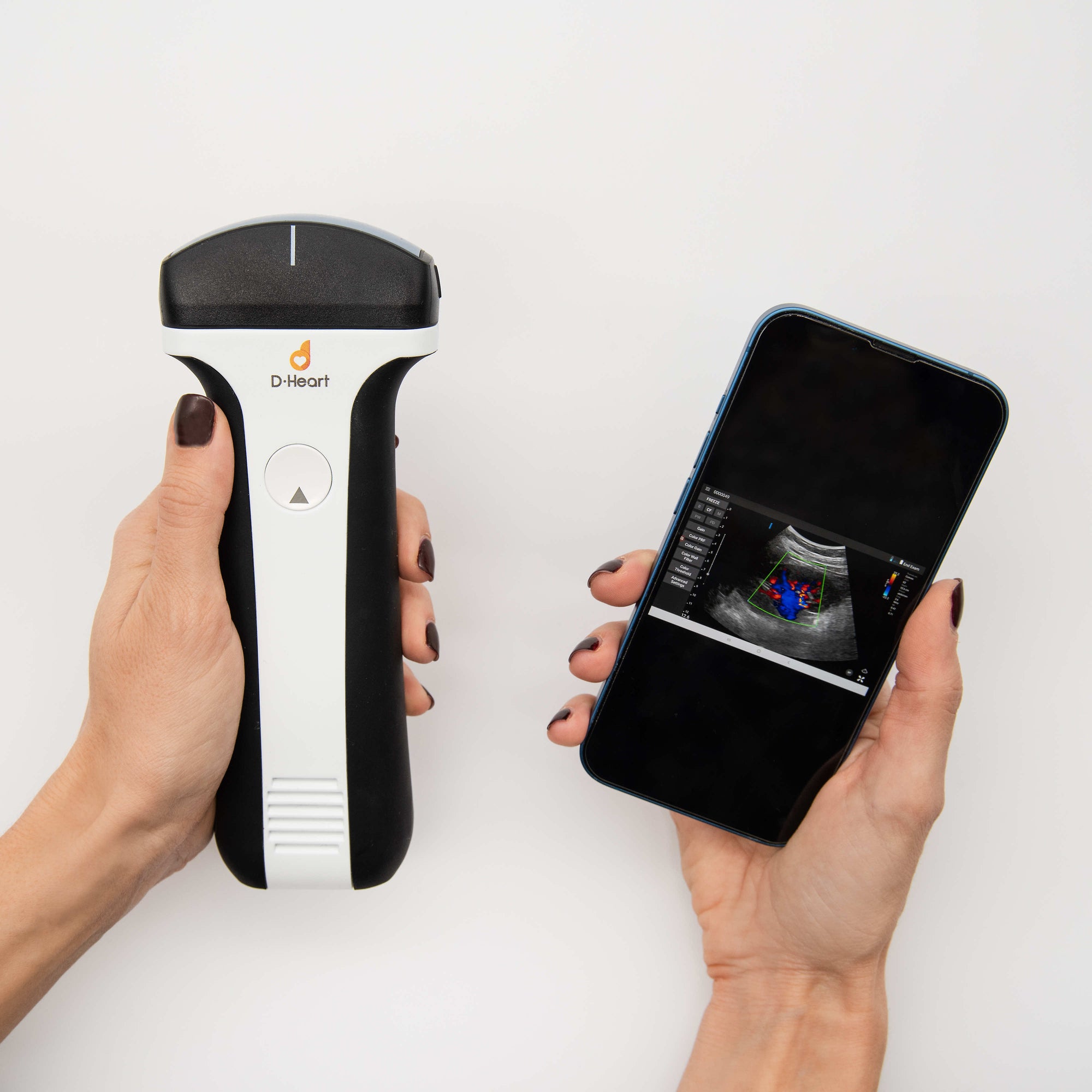 D-HEART SCANNER CONVEX