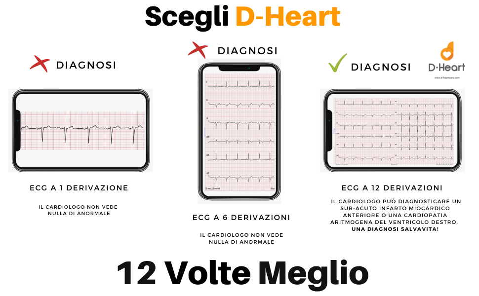 Acquista Carta termica compatibile per ecg BTL, Cardiogima 6M colour e  Progetti, Innomed - 112 mm x 23 m, Doctor Shop