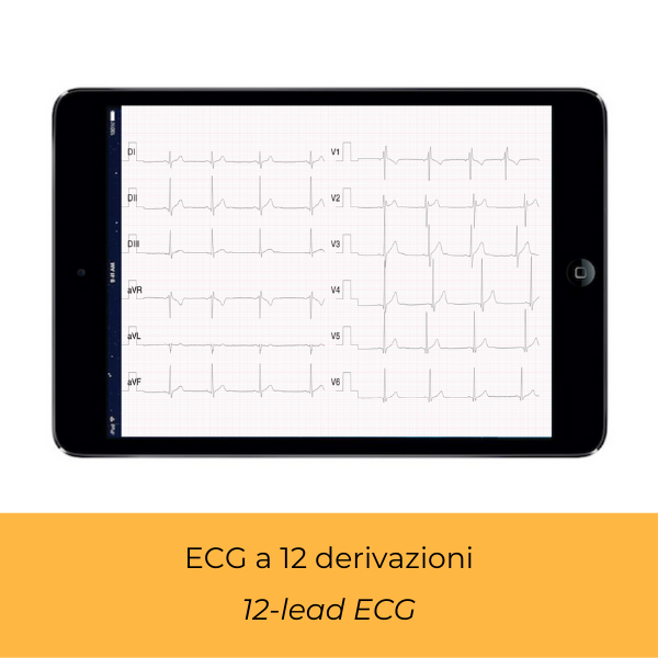 TELECARDIOLOGIA 2.0 - Dispositivo ECG per Farmacisti