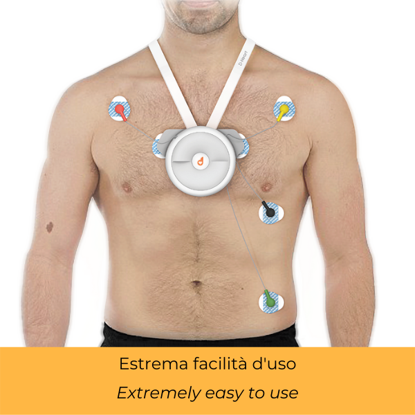 ECG A RIPOSO 12 DERIVAZIONI